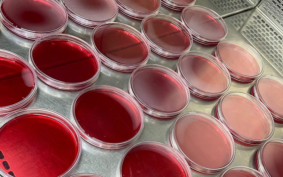 Microbiologia: O que nossos laboratórios oferecem?